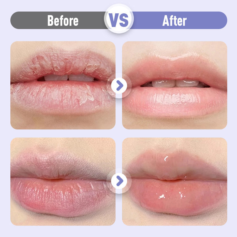 👑Återfuktande läppserum som ger fyllighet och motverkar rynkor💋 - ohneen